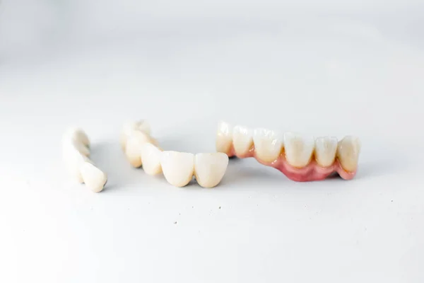 Dental crowns on the white background — Stok fotoğraf