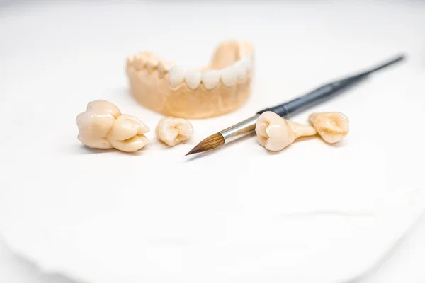 Model of artificial jaw with teeth — 图库照片