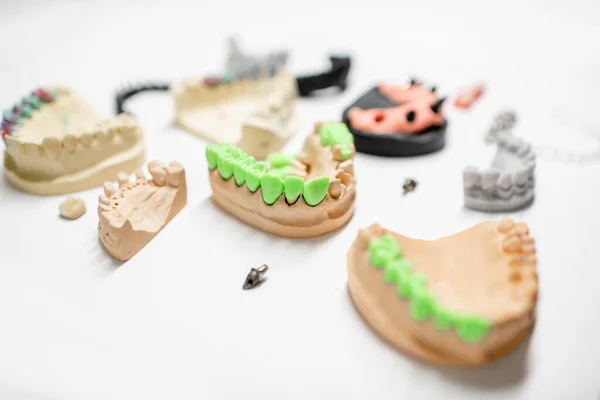 Modelos artificiales de mandíbula con implantes dentales — Foto de Stock