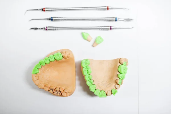 Mandíbulas artificiales con dientes verdes — Foto de Stock