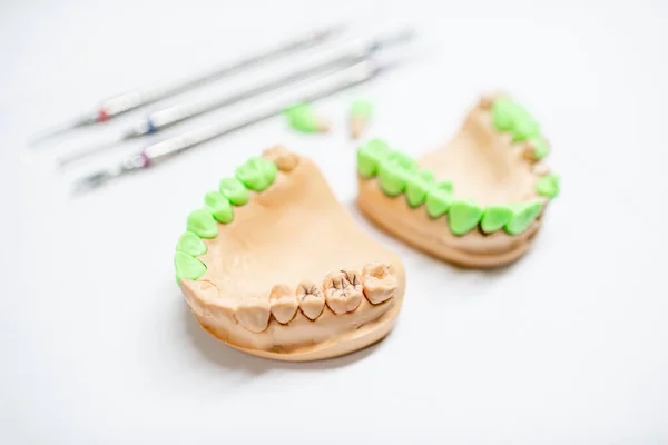 Mandíbulas artificiales con dientes verdes — Foto de Stock
