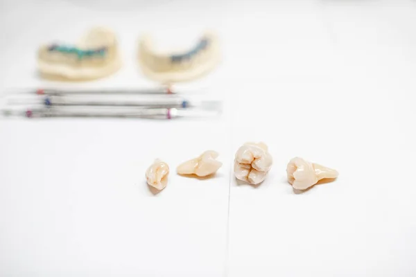 Beyaz arka plan üzerinde yapay diş — Stok fotoğraf