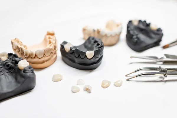Artificial jaw models with veneers — Stok fotoğraf