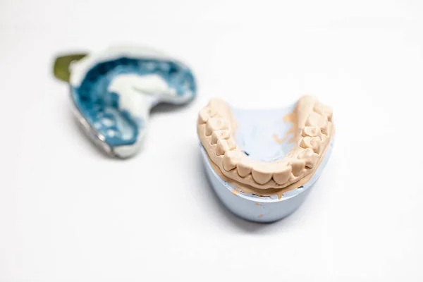 Artificial plaster jaw model with impression — 스톡 사진