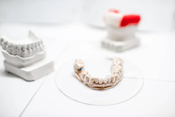 Gypsum models of artificial jaw with dental caps — Stok fotoğraf