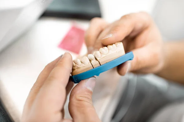 Técnico dental trabajando en la mandíbula de yeso — Foto de Stock