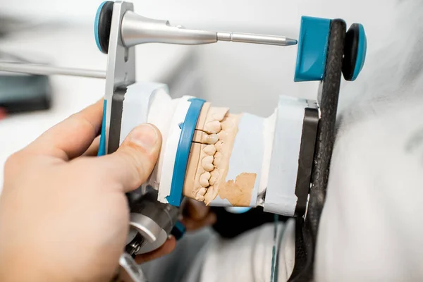 Dental technician working jaw model — Stok fotoğraf