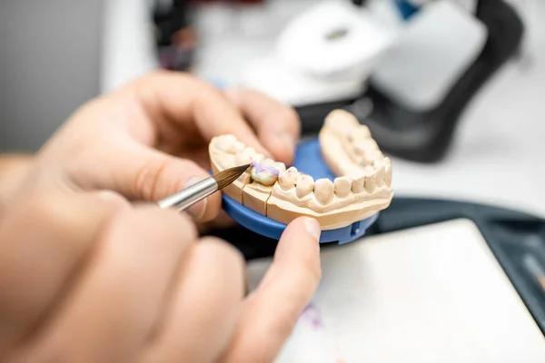 Dental technician coloring dental prosthesis — Stok fotoğraf