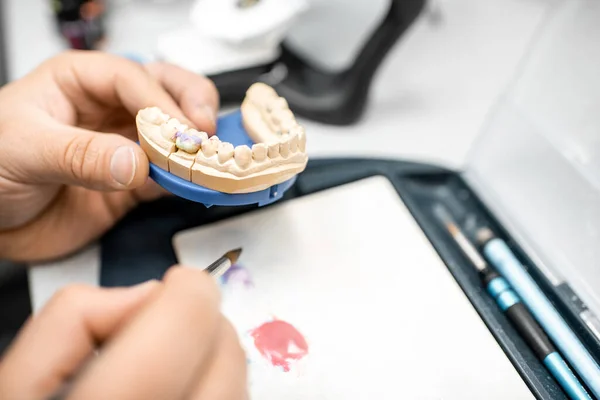 Técnico dental para colorear prótesis dental — Foto de Stock