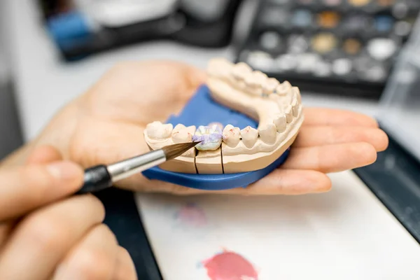 Dental technician coloring dental prosthesis — ストック写真