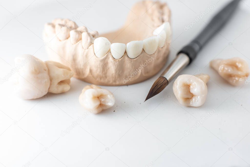 Model of artificial jaw with teeth