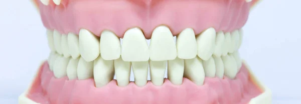 Denti Sul Modello Del Dentista Igiene Orale Dentale Assistenza Sanitaria — Foto Stock