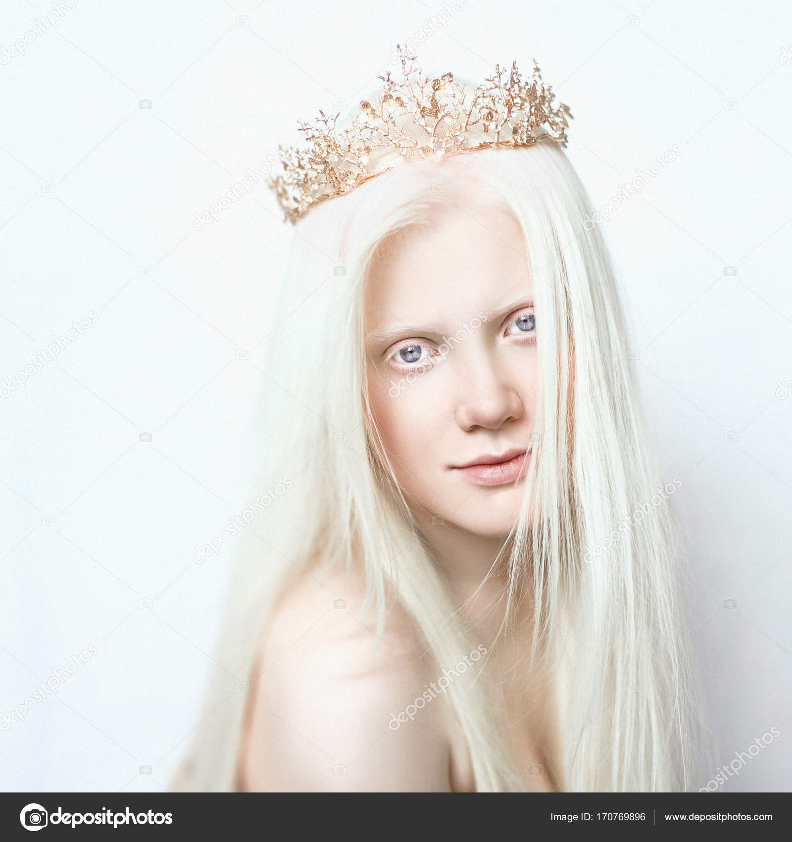 Albino Queen Girl With White Skin Natural Lips And White Hair