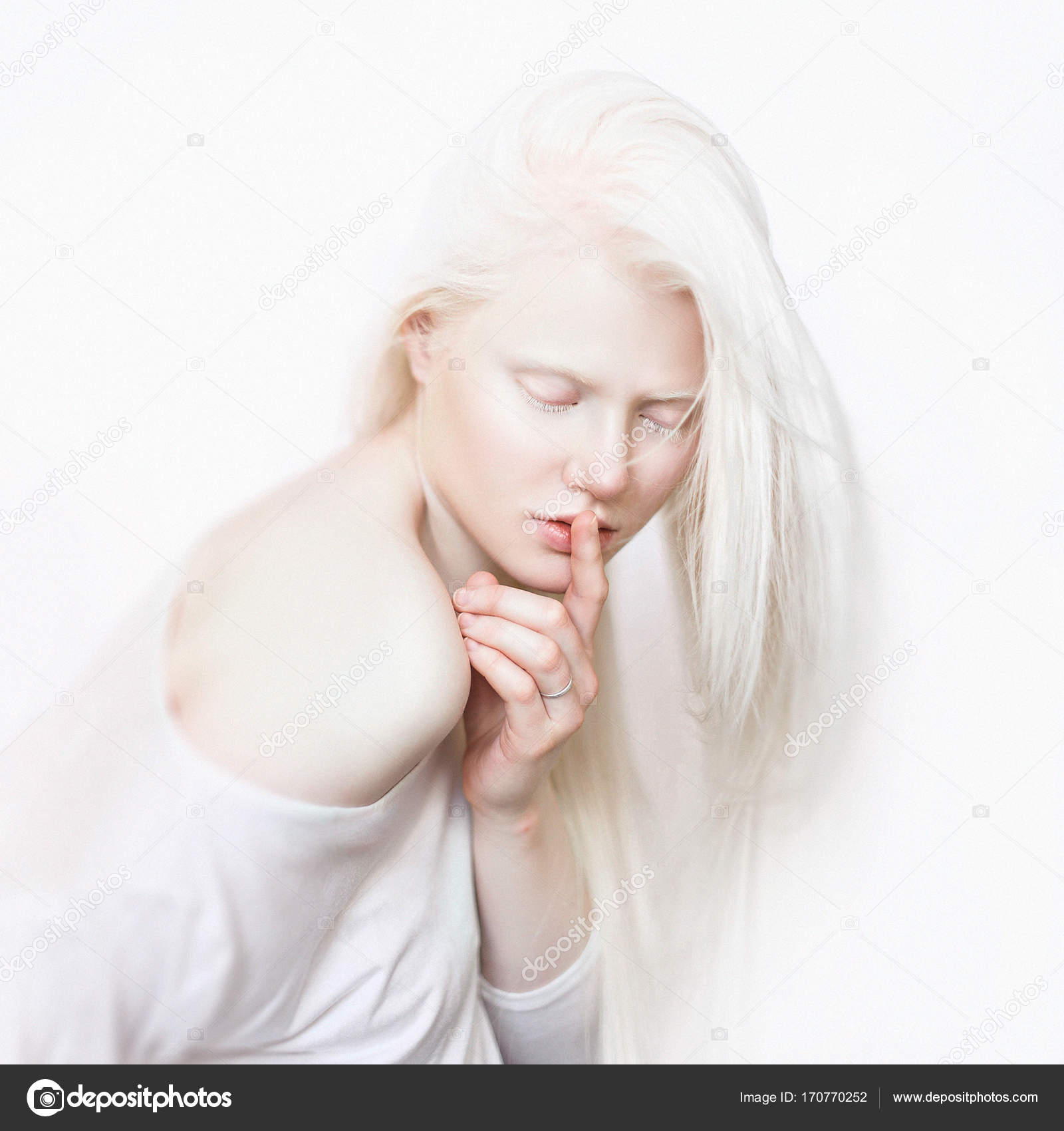 ᐈ Albino Stock Pictures Royalty Free Albinos Images Download On Depositphotos