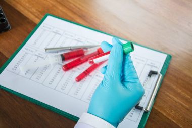 bilim adamı ile test tüpü içinde klinik laboratuvar araştırma yapma.
