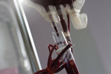 Hopital yatakta komadaki hasta ciddi bir enfeksiyon, koronavirüs, talasemi ve AIDS teşhisi nedeniyle doktor hemşirenin bakımıyla ilgileniyor. Virüs krizini atlatmak için sağlık teknolojisi tedavisine ihtiyacımız var.