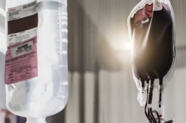 Hopital yatakta komadaki hasta ciddi bir enfeksiyon, koronavirüs, talasemi ve AIDS teşhisi nedeniyle doktor hemşirenin bakımıyla ilgileniyor. Virüs krizini atlatmak için sağlık teknolojisi tedavisine ihtiyacımız var.