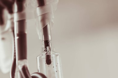 Hopital yatakta komadaki hasta ciddi bir enfeksiyon, koronavirüs, talasemi ve AIDS teşhisi nedeniyle doktor hemşirenin bakımıyla ilgileniyor. Virüs krizini atlatmak için sağlık teknolojisi tedavisine ihtiyacımız var.