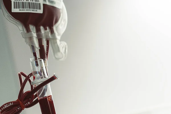 Pacient Kómatu Lůžku Pečovat Lékaře Zdravotní Sestra Kvůli Závažné Infekci — Stock fotografie
