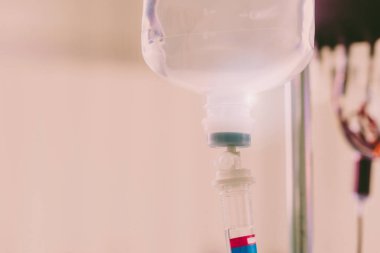 Hopital yatakta komadaki hasta ciddi bir enfeksiyon, koronavirüs, talasemi ve AIDS teşhisi nedeniyle doktor hemşirenin bakımıyla ilgileniyor. Virüs krizini atlatmak için sağlık teknolojisi tedavisine ihtiyacımız var.