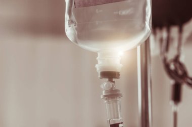 Hopital yatakta komadaki hasta ciddi bir enfeksiyon, koronavirüs, talasemi ve AIDS teşhisi nedeniyle doktor hemşirenin bakımıyla ilgileniyor. Virüs krizini atlatmak için sağlık teknolojisi tedavisine ihtiyacımız var.