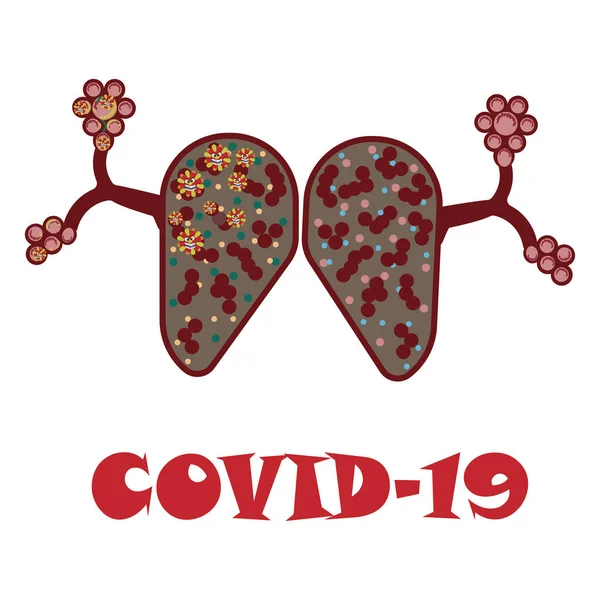 Polmoni Umani Covid Malattia Sars Coronavirus Nel Polmone Coronavirus Causa — Vettoriale Stock