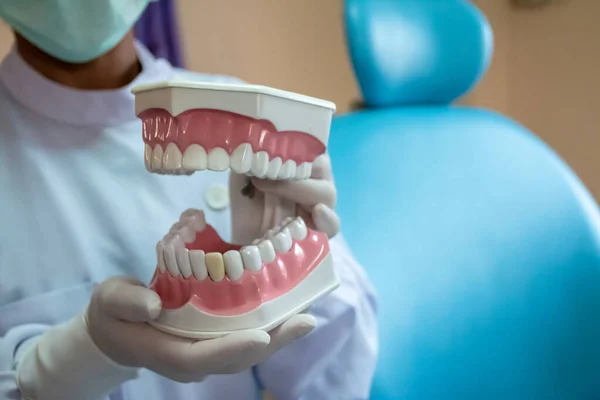 Dentures Dental Clinics Dentists Use Communicate Patients — Stock Photo, Image