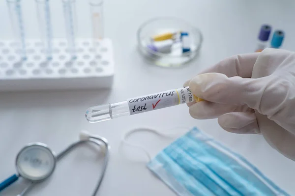 Coronavirus 2019 nCoV kan örneği. Corona virüsü salgını. Salgın Virüs Solunum Sendromu. Çin. Covid 19