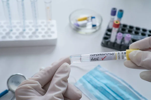 Coronavirus 2019 nCoV kan örneği. Corona virüsü salgını. Salgın Virüs Solunum Sendromu. Çin. Covid 19