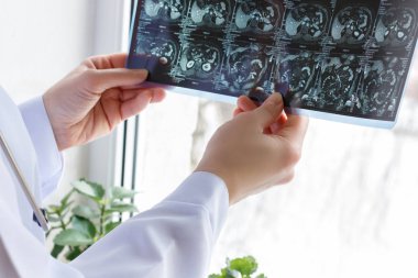 Doktor Röntgen, hasta görünüyor..