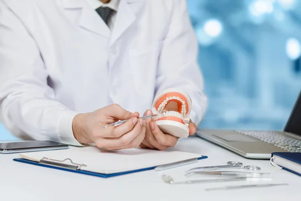 Médico en la mesa muestra un modelo de la cavidad oral . —  Fotos de Stock