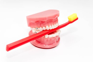 Ortodontik model ve dişçi aleti. Yapay çenelerde seramik diş teli olan bir model. Kırmızı diş fırçalı çene modeli. Diş sağlığı, ilaç, tıbbi ekipman ve stomatoloji kavramı.