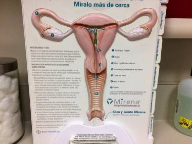 IUD doğum kontrollü dişi üreme modeli