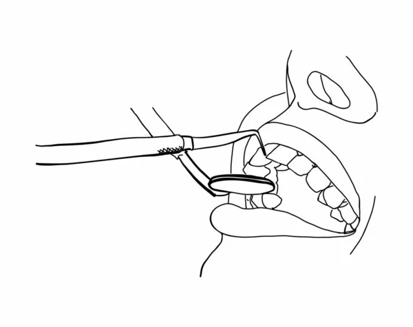 Instruments médicaux pour l'examen dentaire. Examen dentaire et examen dentaire . — Image vectorielle