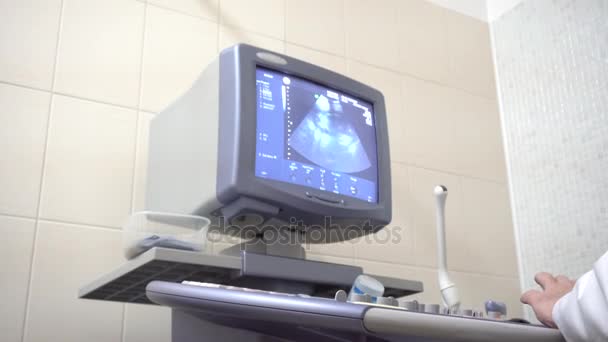 The doctor makes measurements on the ultrasound screen — Stock Video