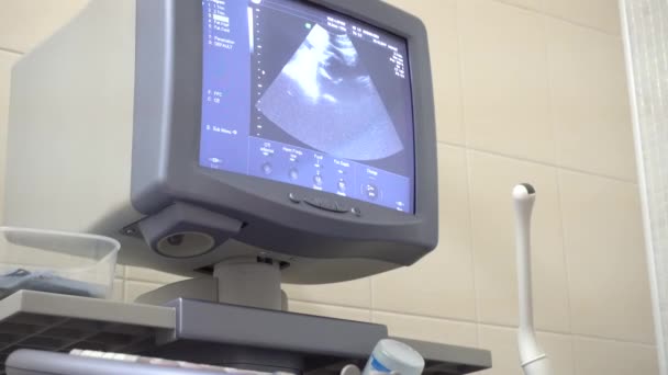 Doctors monitor ultrasound in 4k — Stock Video