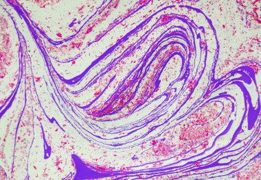 Mermer soyut akrilik zemin. Doğa yeşili mermer sanat eseri dokusu. Altın parıltı.