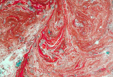 Mermer soyut akrilik zemin. Doğa yeşili mermer sanat eseri dokusu. Altın parıltı.