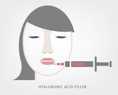 Dudak enjeksiyon görüntü