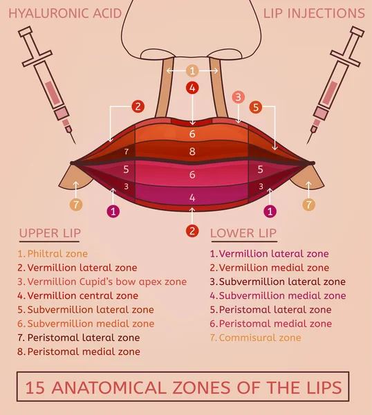 Lèvres injections Image — Image vectorielle