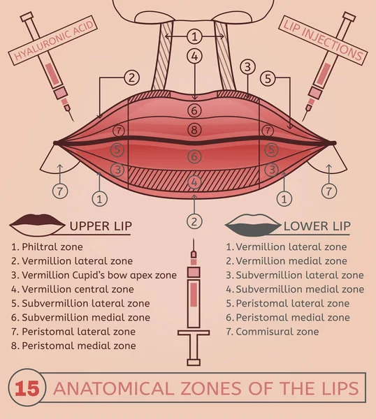 Inyecciones de labios Imagen — Vector de stock