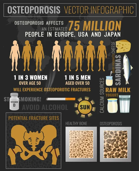 Osteoporoz Infographic Poster — Stok Vektör