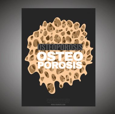 Osteoporosis Poster Template clipart