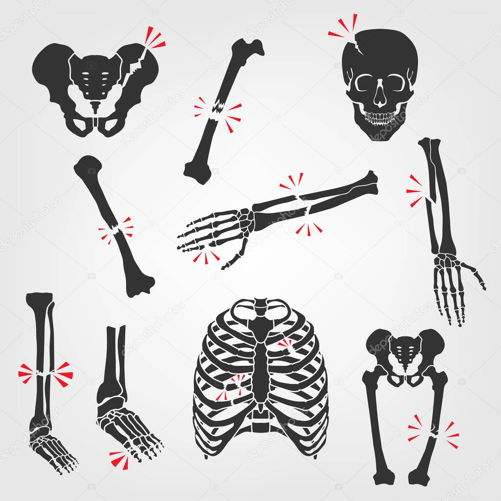 Bones Fractures Icons