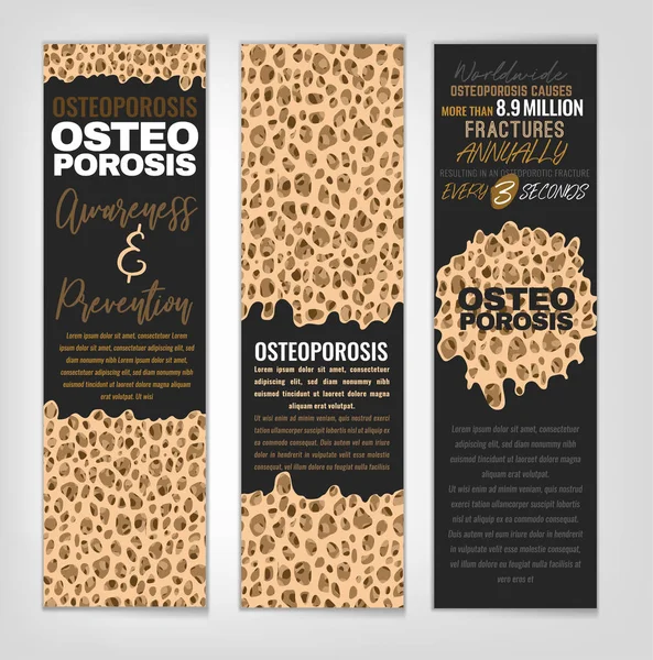 Osteoporosis Banners Set — Stock Vector