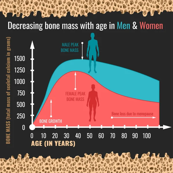 Уменьшение массы костей — стоковый вектор
