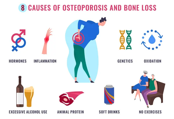 Osteoporosis Infografía Poster — Vector de stock