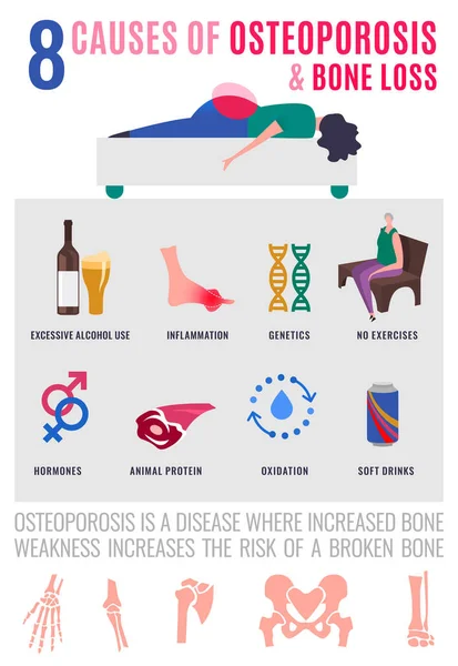 Ursachen Für Osteoporose Und Knochenschwund Medizinisches Infoplakat Gesundheitswesen Medizin Frühpräventionskonzept — Stockvektor