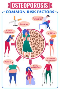 Osteoporoz ve kemik kaybına neden olur. Tıbbi bilgi afişi. Sağlık, ilaç, erken önleme kavramı. Dikey format. Modern öncü sadelik tarzında simgelerle vektör illüstrasyonu