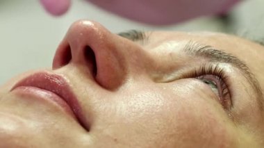 A woman is preparing for a laser rejuvenation procedure in the salon. A cosmetologist-dermatologist completes the photorejuvenation procedure. Shooting is from different angles